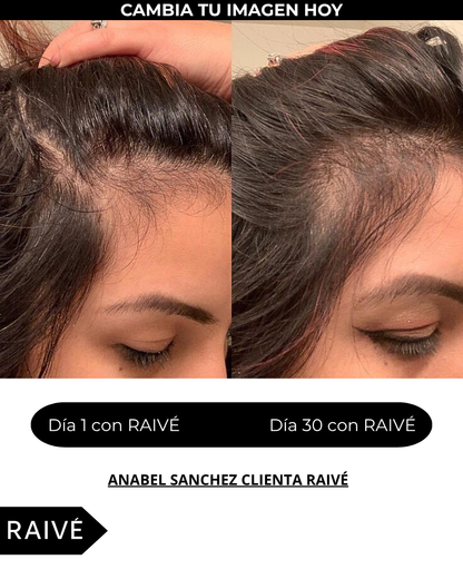 Spray Activador de Crecimiento Capilar: Tratamiento Anticaída + Masajeador Capilar – 150 ML