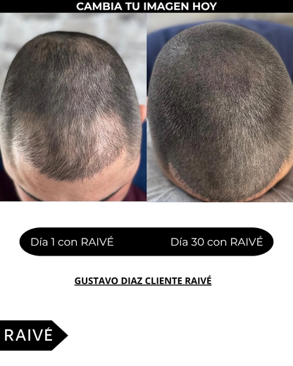 Spray Activador de Crecimiento Capilar: Tratamiento Anticaída + Masajeador Capilar – 150 ML